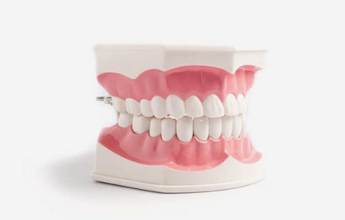 Dental Jaw Model